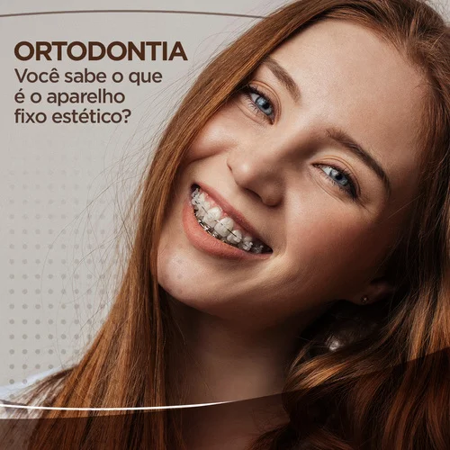 Voce-sabe-o-que-e-o-aparelho-fixo-estetico.